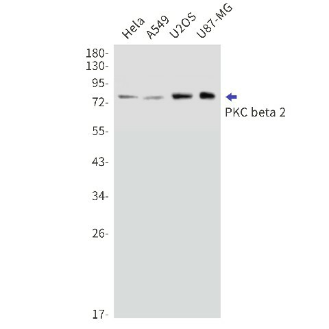 Recombinant PKC beta 2 Monoclonal Antibody (E-AB-81518)