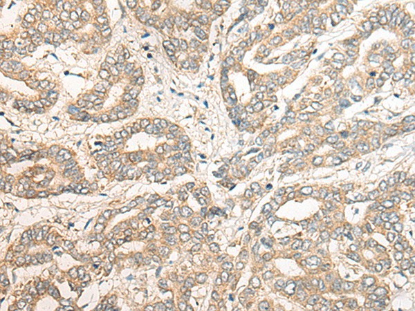 PCDHGB5 Polyclonal Antibody (E-AB-17857)