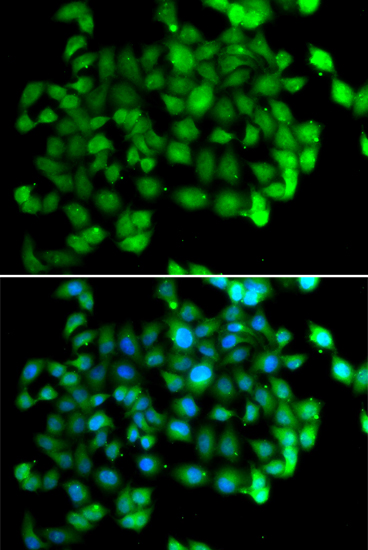 APOBEC3C Polyclonal Antibody (E-AB-67714)