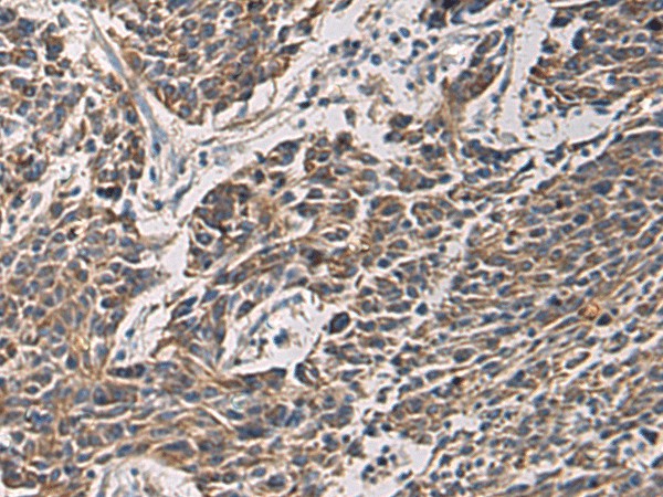 MAPKAPK3 Polyclonal Antibody (E-AB-19263)