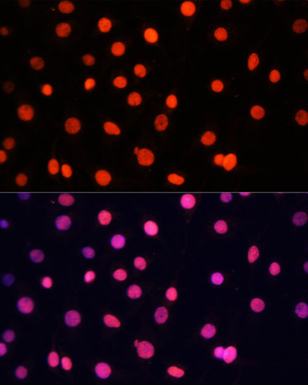SOX2 Polyclonal Antibody (E-AB-63542)