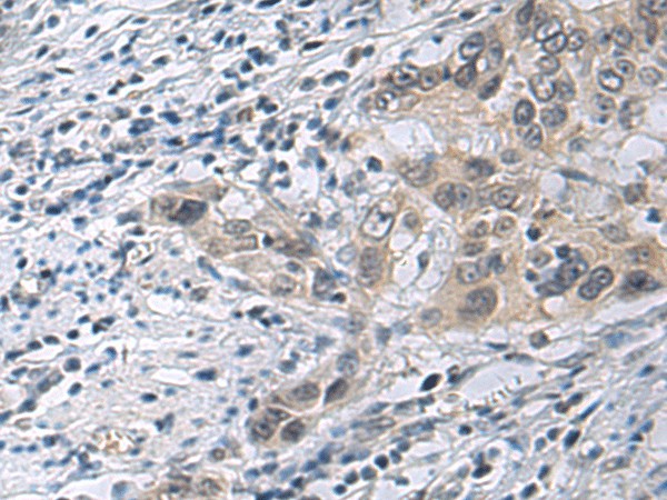 IRS4 Polyclonal Antibody (E-AB-53259)
