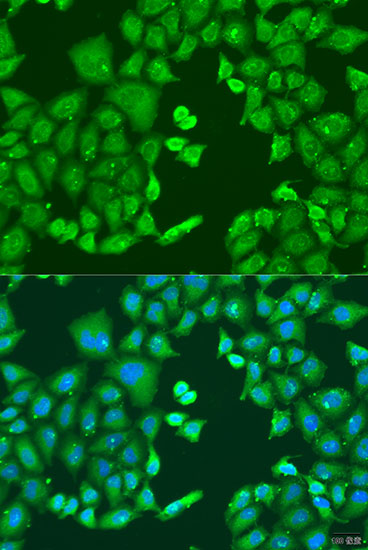 CYP11B1 Polyclonal Antibody (E-AB-66405)