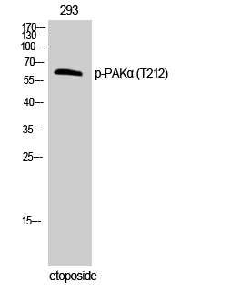 Phospho-PAK1 (Thr212) Polyclonal Antibody (E-AB-21179)
