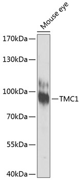 TMC1 Polyclonal Antibody (E-AB-63885)