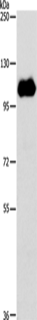 NOTCH1 Polyclonal Antibody (E-AB-12815)