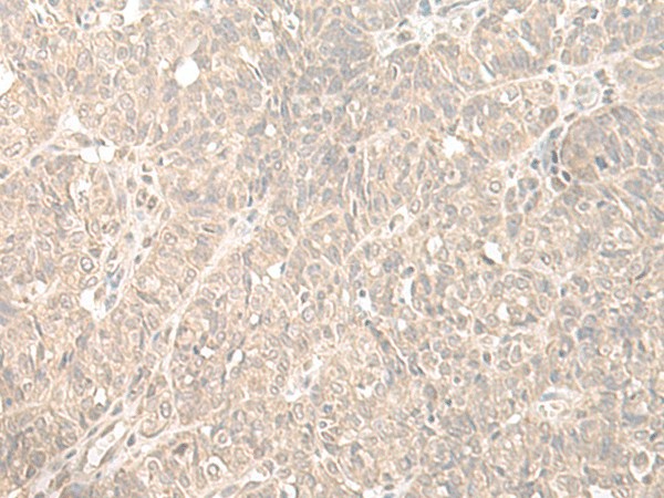 HENMT1 Polyclonal Antibody (E-AB-52626)