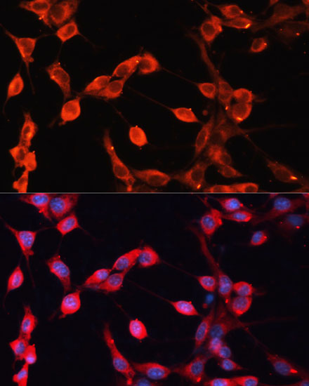 ADAMTS13 Polyclonal Antibody (E-AB-67992)