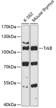 TrkB Polyclonal Antibody (E-AB-93076)