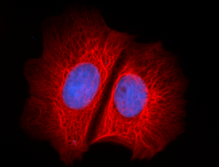 Alexa Fluor® 647 anti-Cytokeratin (pan reactive) Antibody (628604)