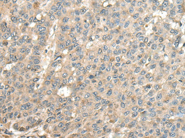CASQ1 Polyclonal Antibody (E-AB-52513)