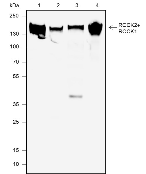 Recombinant ROCK2+ROCK1 Monoclonal Antibody (AN301910L)