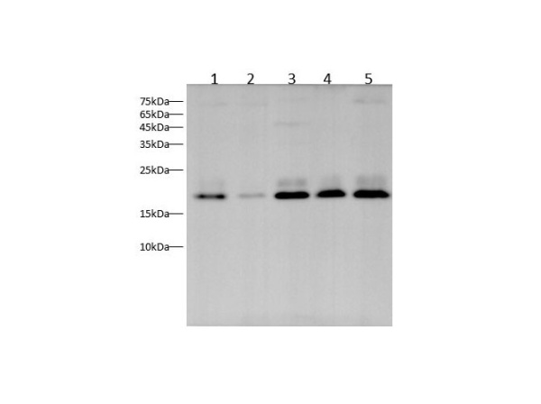 NRAS Polyclonal Antibody (D-AB-10191L)