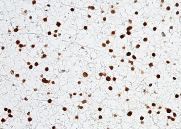 Recombinant Olig-2/Oligo2 Monoclonal Antibody (AN300139P)