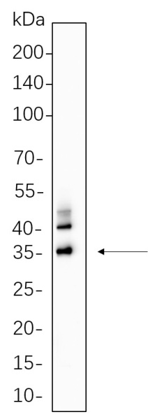 Recombinant C/EBP α Monoclonal Antibody (AN300671L)