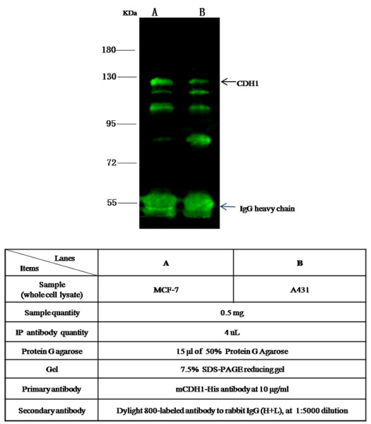 Recombinant E-Cadherin/CDH1/E-cad/CD324 Monoclonal Antibody (AN300543P)