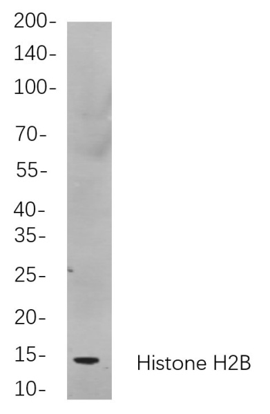Recombinant Histone H2B Monoclonal Antibody (AN300917L)