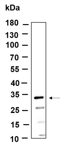 Recombinant MTX3 Monoclonal Antibody (AN301213L)