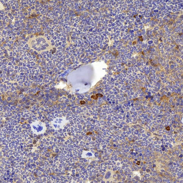 BMP4 Polyclonal Antibody (E-AB-70376)
