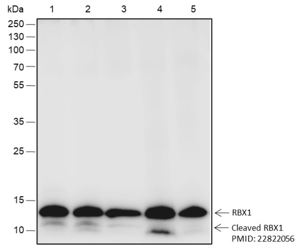 Recombinant RBX1 Monoclonal Antibody (AN301789L)
