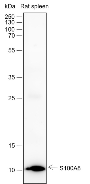 Recombinant S100A8 Monoclonal Antibody (AN301719L)