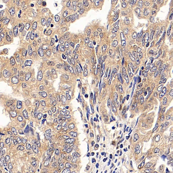 PGR Polyclonal Antibody (E-AB-70121)