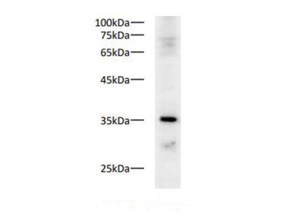 PCNA Polyclonal Antibody (E-AB-40514)