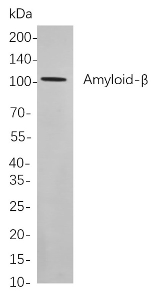 Recombinant Amyloid-β Monoclonal Antibody (AN300886L)