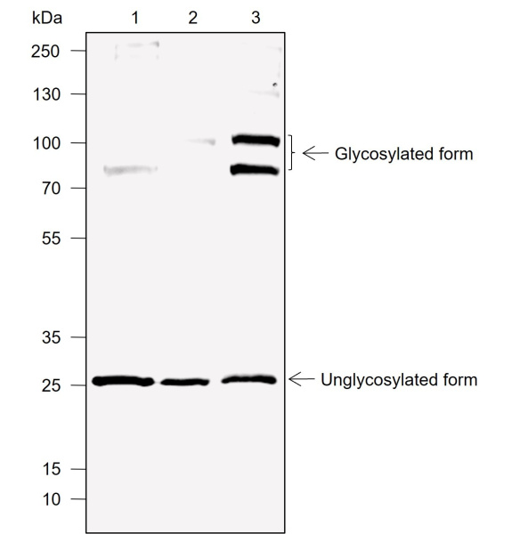 Recombinant DcR1 Monoclonal Antibody (AN301996L)