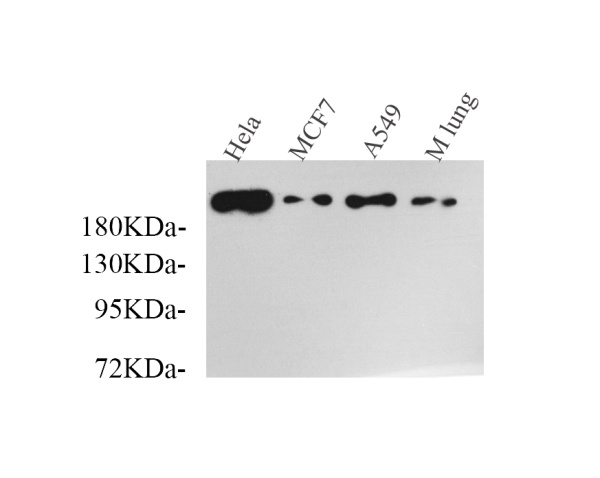 SMARCA4 Polyclonal Antibody (E-AB-70117)