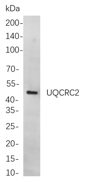 Recombinant UQCRC2 Monoclonal Antibody (AN301063L)