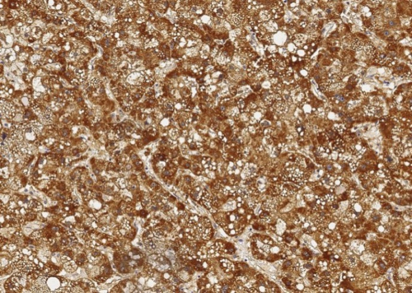 ALDH7A1 Monoclonal Antibody (AN200032P)