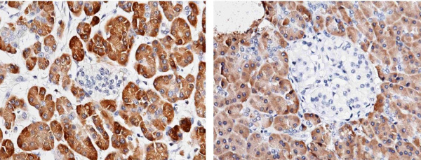 Carboxypeptidase A2/CPA2 Monoclonal Antibody (AN200178P)