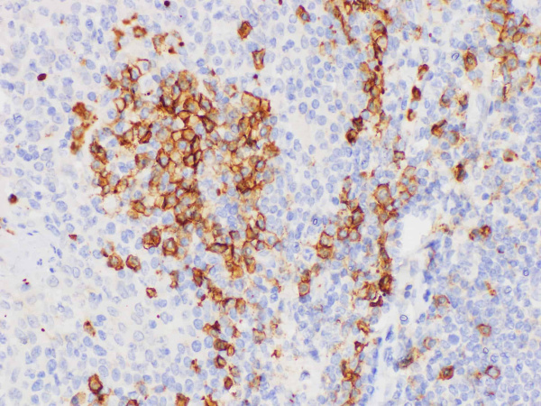 CD38 Polyclonal Antibody (E-AB-40434)