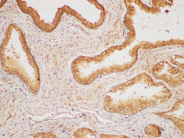 HRAS Polyclonal Antibody (E-AB-40406)