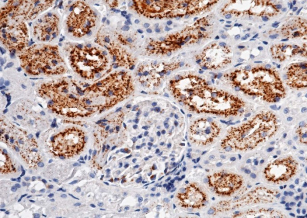 Recombinant Cystatin C/CST3 Monoclonal Antibody (AN300580P)