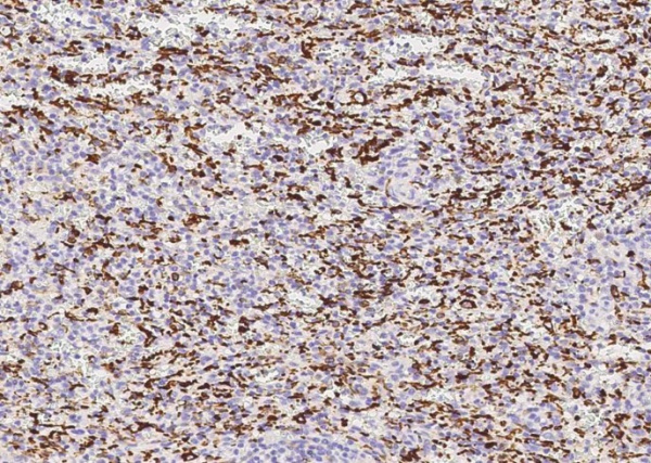 Recombinant IBA1/AIF1 Monoclonal Antibody (AN300448P)