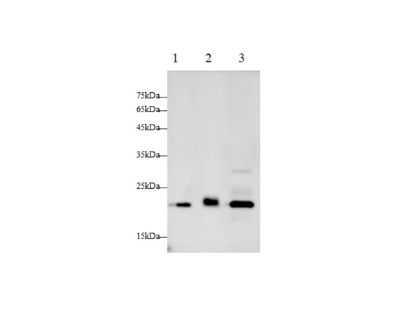 CTSB Polyclonal Antibody (AN006970L)