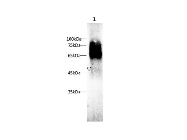 PSAP Polyclonal Antibody (AN006050L)