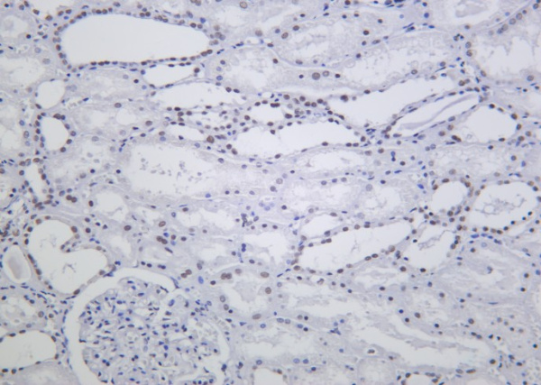 Recombinant ARID1A Monoclonal Antibody (AN301261L)