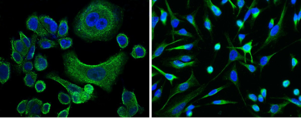 AFP/alpha-fetoprotein Monoclonal Antibody (AN200018P)