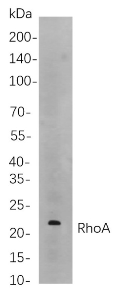 Recombinant RhoA Monoclonal Antibody (AN301113L)