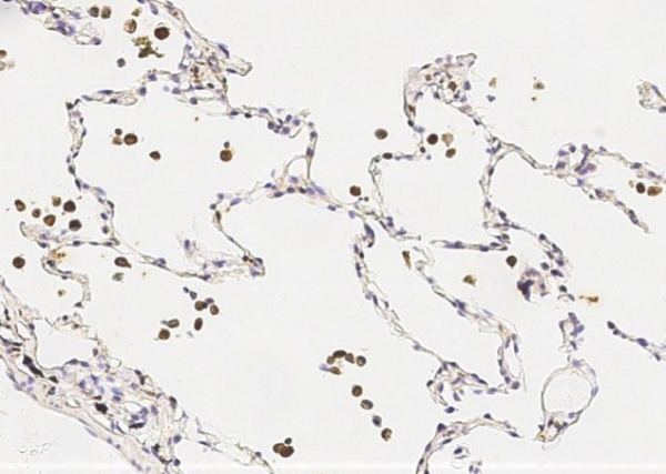IL-1 beta/IL1B Monoclonal Antibody (AN200015P)