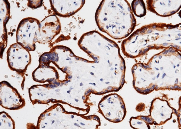 Recombinant Transferrin Receptor/TFRC/CD71 Monoclonal Antibody (AN300361P)