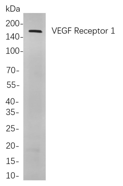 Recombinant VEGF Receptor 1 Monoclonal Antibody (AN301010L)