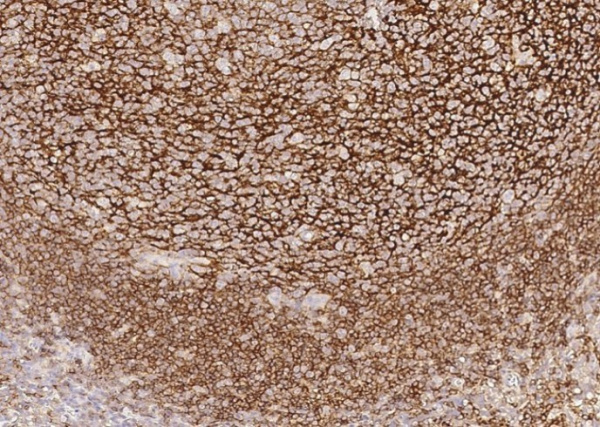 CD21 Monoclonal Antibody (AN200013P)