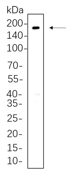 Recombinant ErbB-3 Monoclonal Antibody (AN300807L)