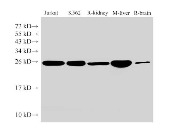 GSTp1 Polyclonal Antibody (D-AB-10131L)