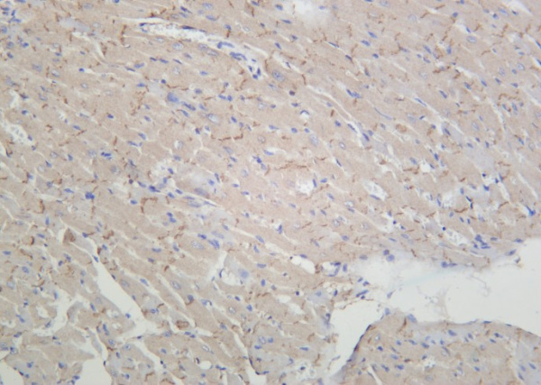 Recombinant pan Cadherin Monoclonal Antibody (AN301116L)