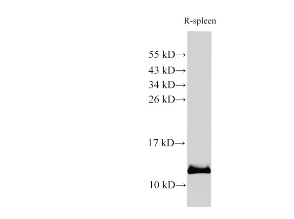 S100A9 Polyclonal Antibody (E-AB-40317)